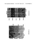 METHOD FOR TREATING TYPE 1 DIABETES diagram and image