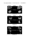 METHOD FOR TREATING TYPE 1 DIABETES diagram and image