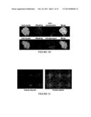 METHOD FOR TREATING TYPE 1 DIABETES diagram and image