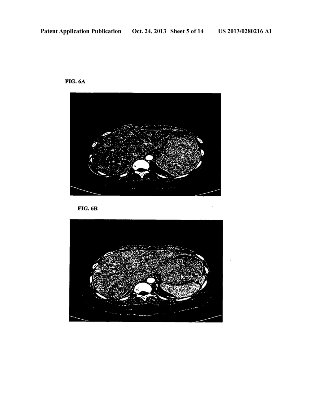 Methods for Use of a Specific Anti-Angiogenic Adenoviral Agent - diagram, schematic, and image 06