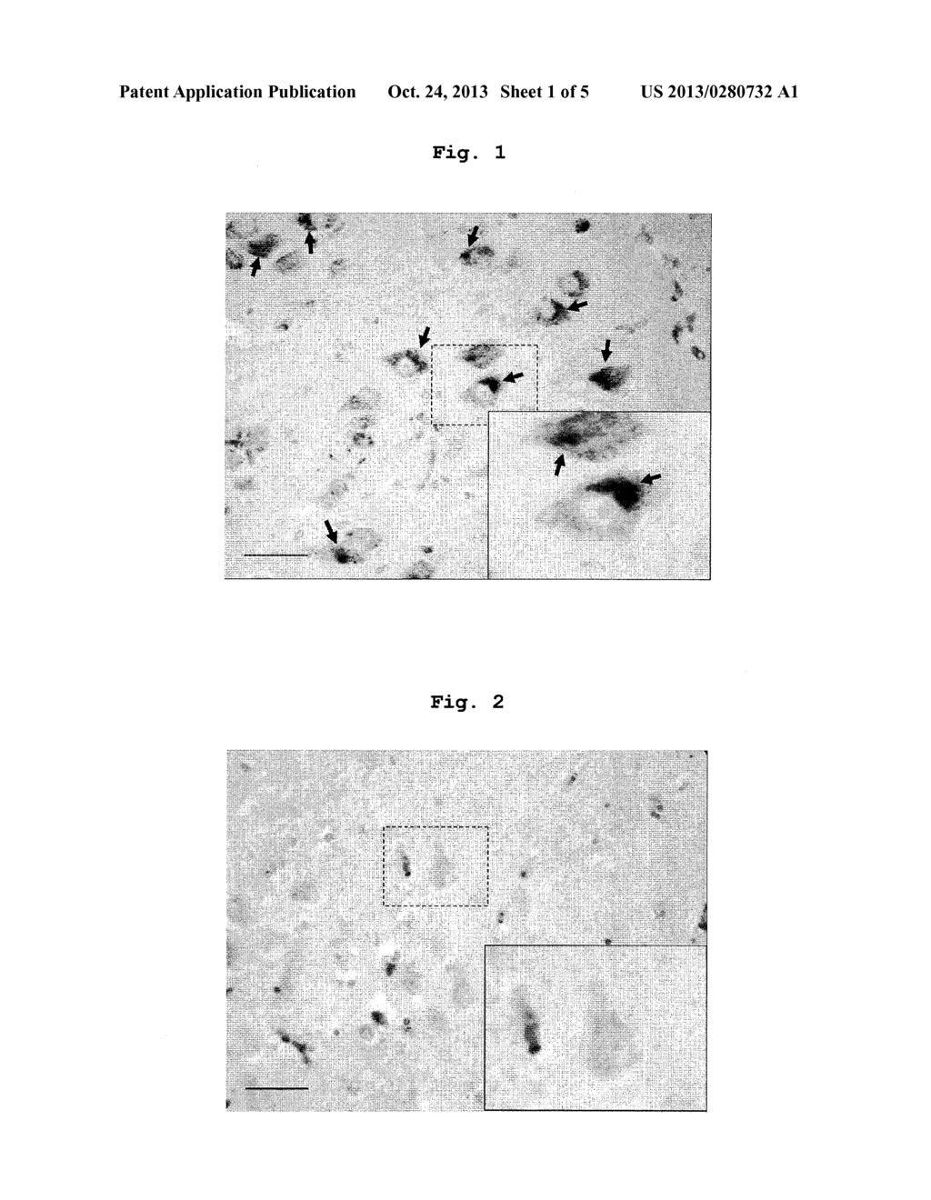 DIAGNOSTIC DRUG AND DIAGNOSTIC METHOD FOR ALZHEIMER'S DISEASE - diagram, schematic, and image 02