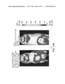 NOVEL TLR4 INHIBITORS FOR THE TREATMENT OF HUMAN INFECTIOUS AND     INFLAMMATORY DISORDERS diagram and image