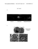 TARGETING GLIOMA STEM CELLS BY SEQUENCE-SPECIFIC FUNCTIONAL INHIBITION OF     PRO-SURVIVAL ONCOMIR-138 diagram and image