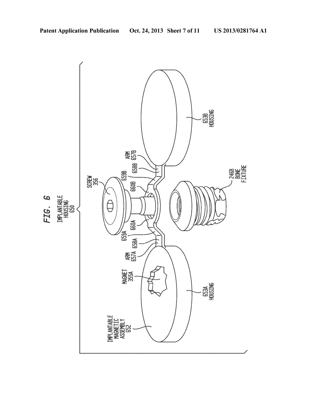 TRANSCUTANEOUS BONE CONDUCTION DEVICE - diagram, schematic, and image 08