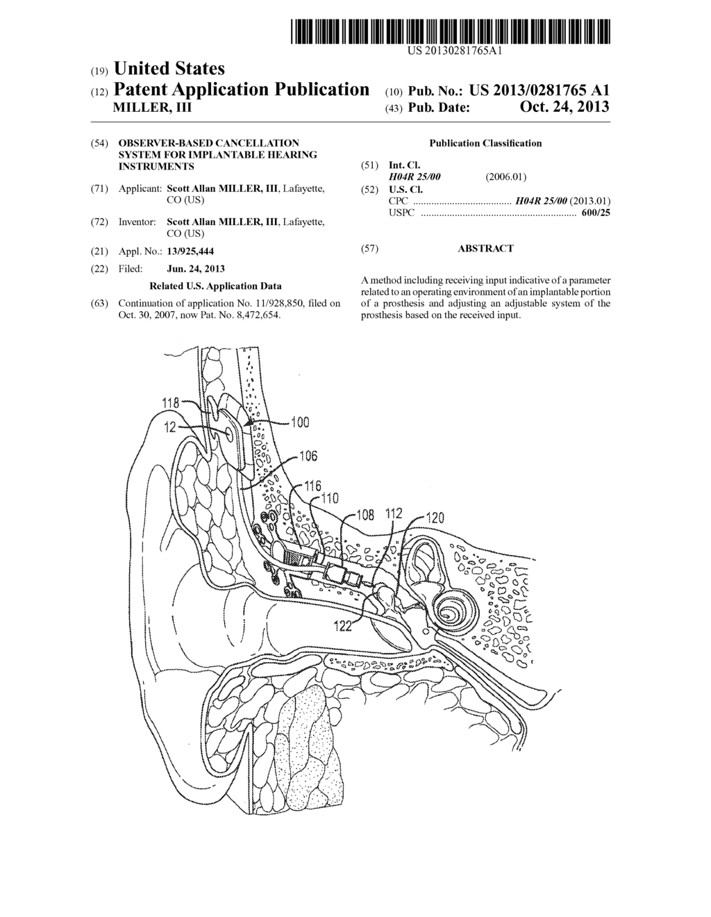 OBSERVER-BASED CANCELLATION SYSTEM FOR IMPLANTABLE HEARING INSTRUMENTS - diagram, schematic, and image 01