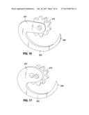 IMPLANTABLE ACCESS PORT SYSTEM diagram and image