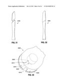 IMPLANTABLE ACCESS PORT SYSTEM diagram and image