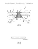 Implants And Procedures For Treatment Of  Pelvic Floor Disorders diagram and image