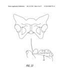 Implants And Procedures For Treatment Of  Pelvic Floor Disorders diagram and image