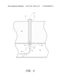 VASCULAR WOUND CLOSURE DEVICE AND METHOD diagram and image