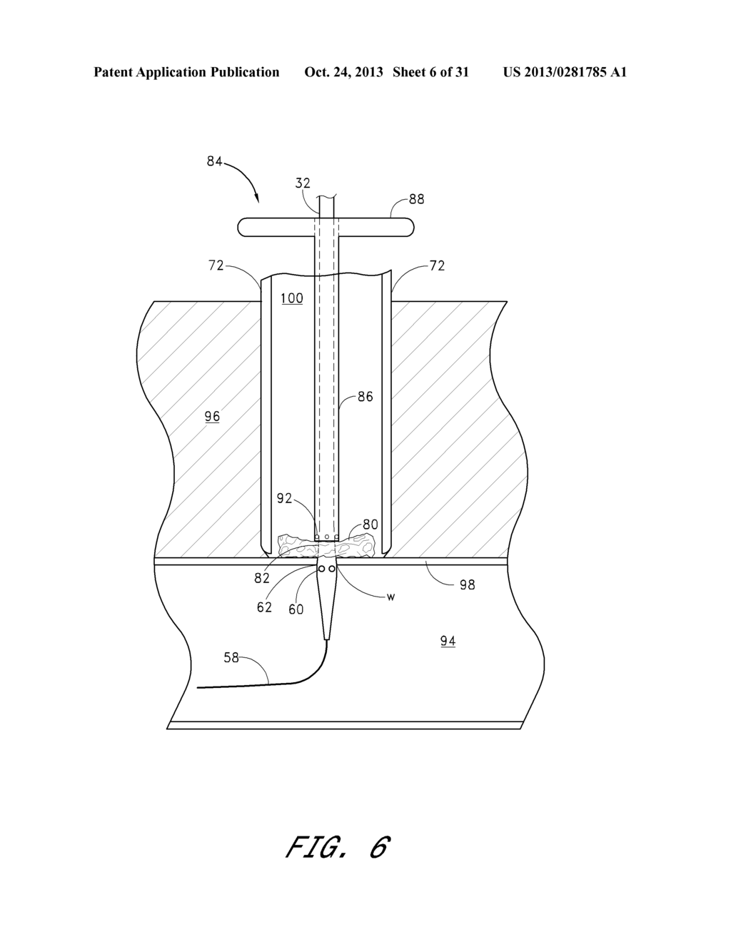 VASCULAR WOUND CLOSURE DEVICE AND METHOD - diagram, schematic, and image 07