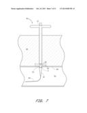 VASCULAR WOUND CLOSURE DEVICE AND METHOD diagram and image