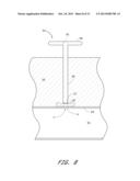 VASCULAR WOUND CLOSURE DEVICE AND METHOD diagram and image