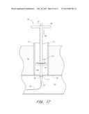 VASCULAR WOUND CLOSURE DEVICE AND METHOD diagram and image