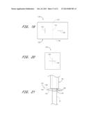 VASCULAR WOUND CLOSURE DEVICE AND METHOD diagram and image