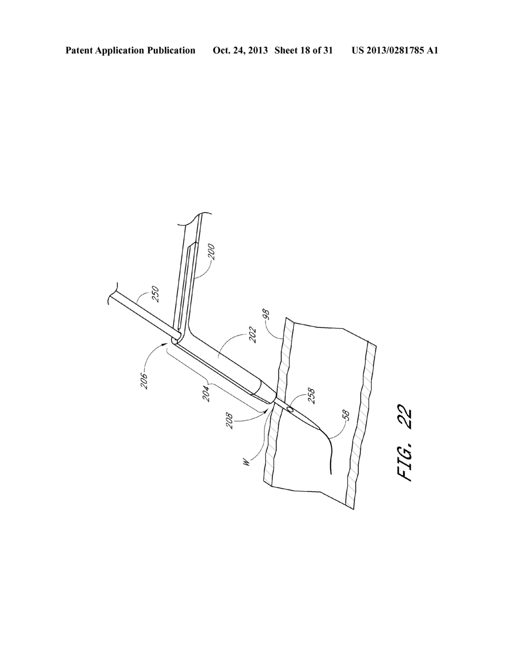 VASCULAR WOUND CLOSURE DEVICE AND METHOD - diagram, schematic, and image 19