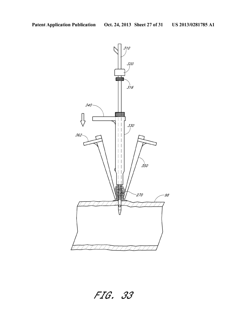 VASCULAR WOUND CLOSURE DEVICE AND METHOD - diagram, schematic, and image 28