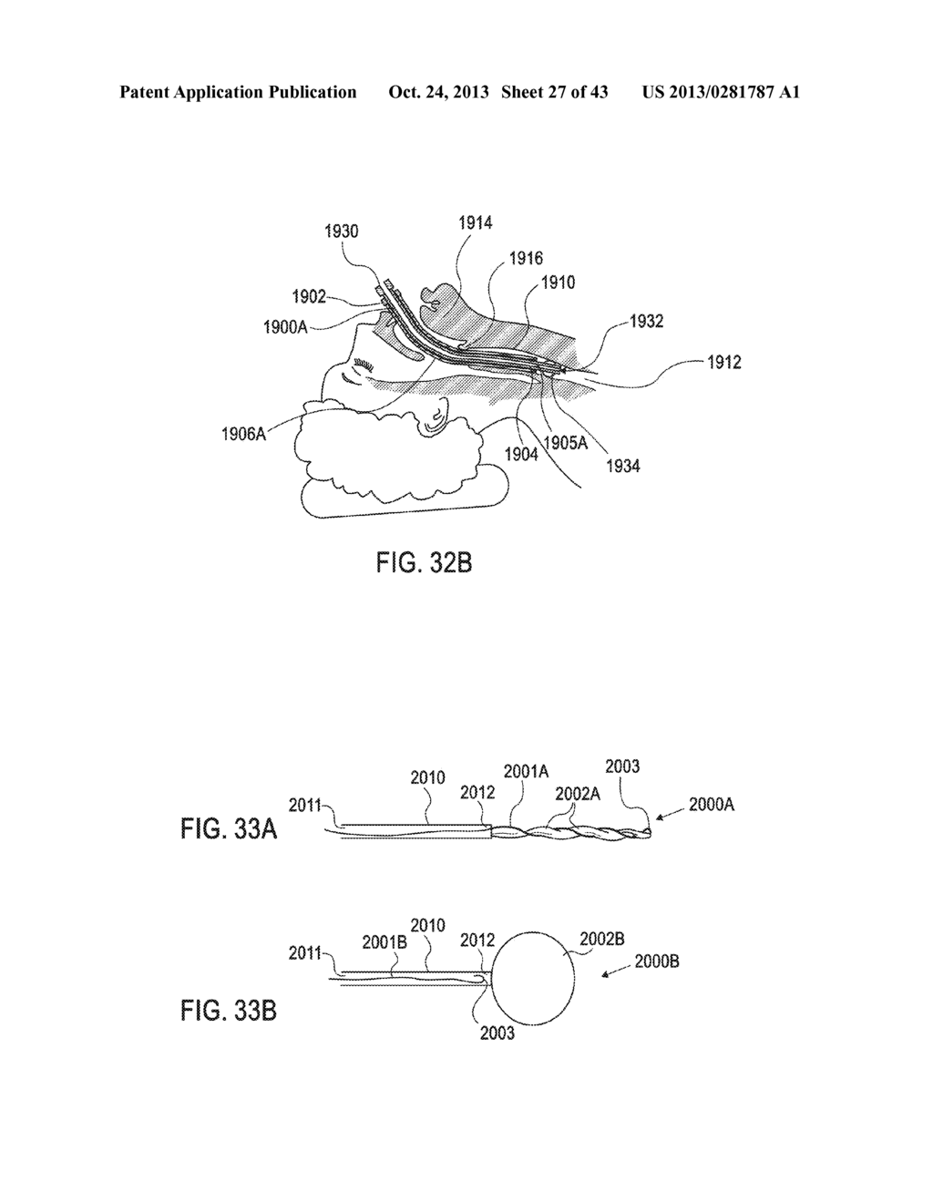 DEVICES AND METHODS FOR ENDOVASCULAR ACCESS AND THERAPY - diagram, schematic, and image 28