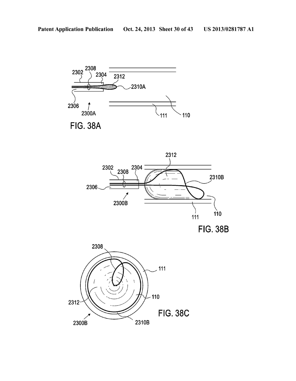 DEVICES AND METHODS FOR ENDOVASCULAR ACCESS AND THERAPY - diagram, schematic, and image 31