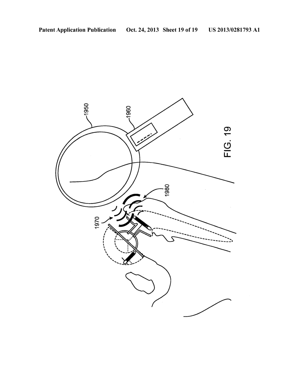 BREACH DETECTION IN SOLID STRUCTURES - diagram, schematic, and image 20