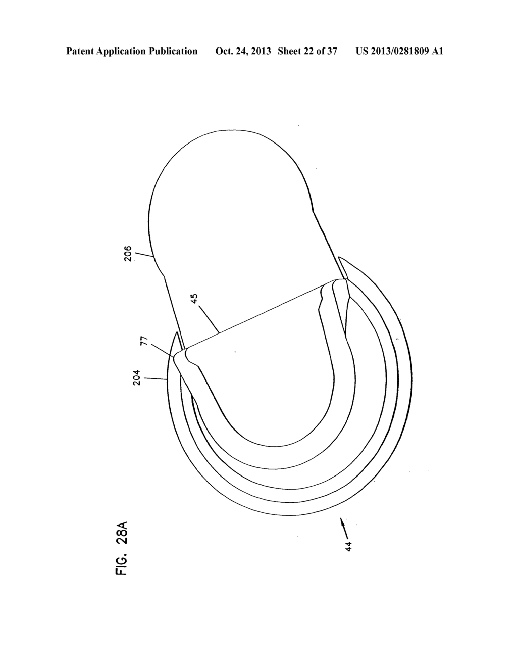 Analyte Monitoring Device and Methods of Use - diagram, schematic, and image 23