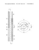 MEASUREMENT AND RESULTING COMPENSATION OF INTRAMEDULLARY NAIL DEFORMATION diagram and image