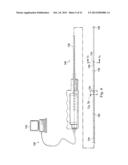 MEASUREMENT AND RESULTING COMPENSATION OF INTRAMEDULLARY NAIL DEFORMATION diagram and image