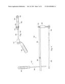 MEASUREMENT AND RESULTING COMPENSATION OF INTRAMEDULLARY NAIL DEFORMATION diagram and image