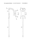 MEASUREMENT AND RESULTING COMPENSATION OF INTRAMEDULLARY NAIL DEFORMATION diagram and image