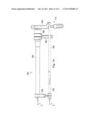 MEASUREMENT AND RESULTING COMPENSATION OF INTRAMEDULLARY NAIL DEFORMATION diagram and image