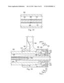 MEASUREMENT AND RESULTING COMPENSATION OF INTRAMEDULLARY NAIL DEFORMATION diagram and image