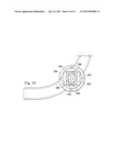 MEASUREMENT AND RESULTING COMPENSATION OF INTRAMEDULLARY NAIL DEFORMATION diagram and image