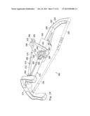 MEASUREMENT AND RESULTING COMPENSATION OF INTRAMEDULLARY NAIL DEFORMATION diagram and image