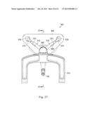 MEASUREMENT AND RESULTING COMPENSATION OF INTRAMEDULLARY NAIL DEFORMATION diagram and image