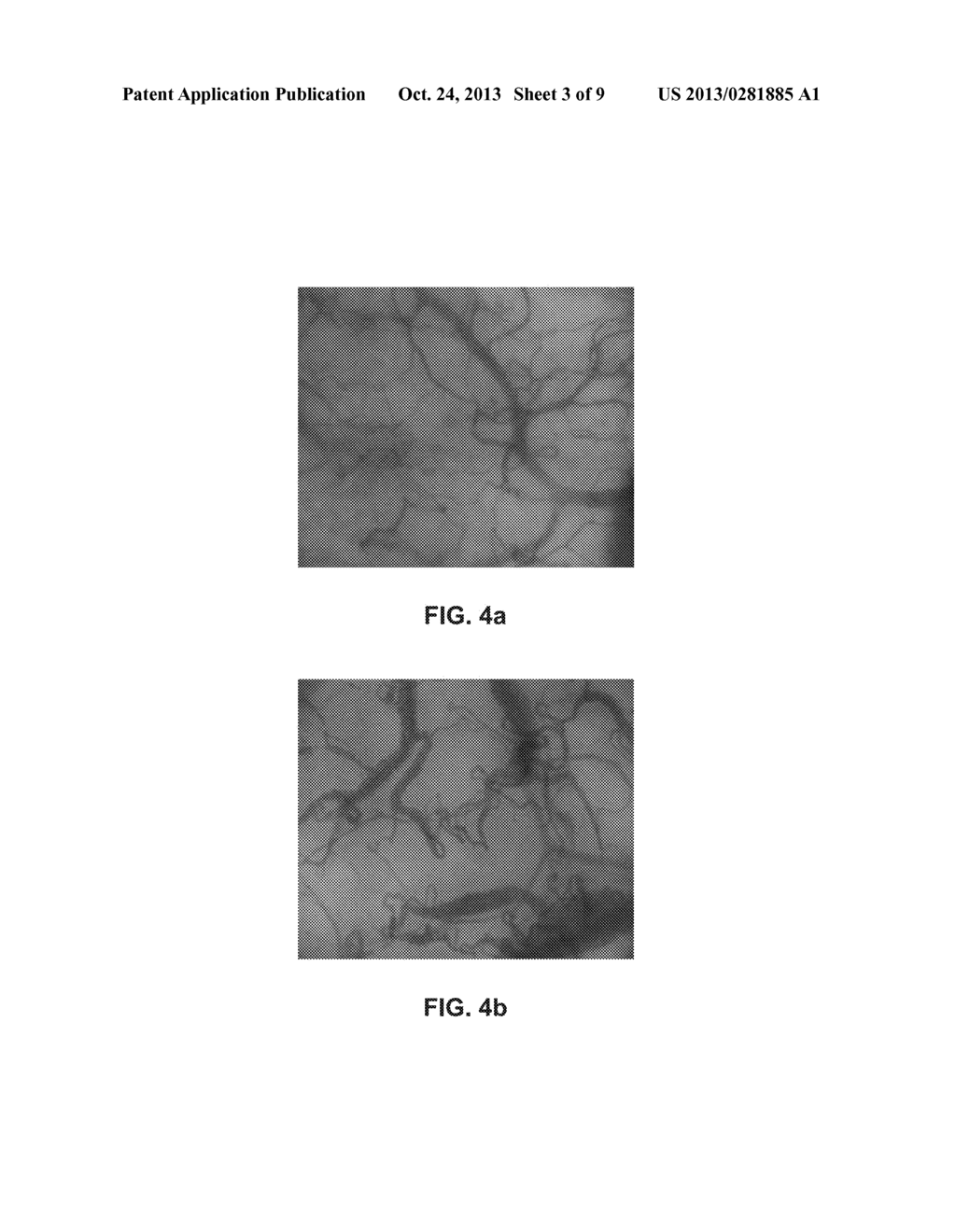 DEVICE WITH EXTERNAL PRESSURE SENSORS FOR ENHANCING PATIENT CARE AND     METHODS OF USING SAME - diagram, schematic, and image 04