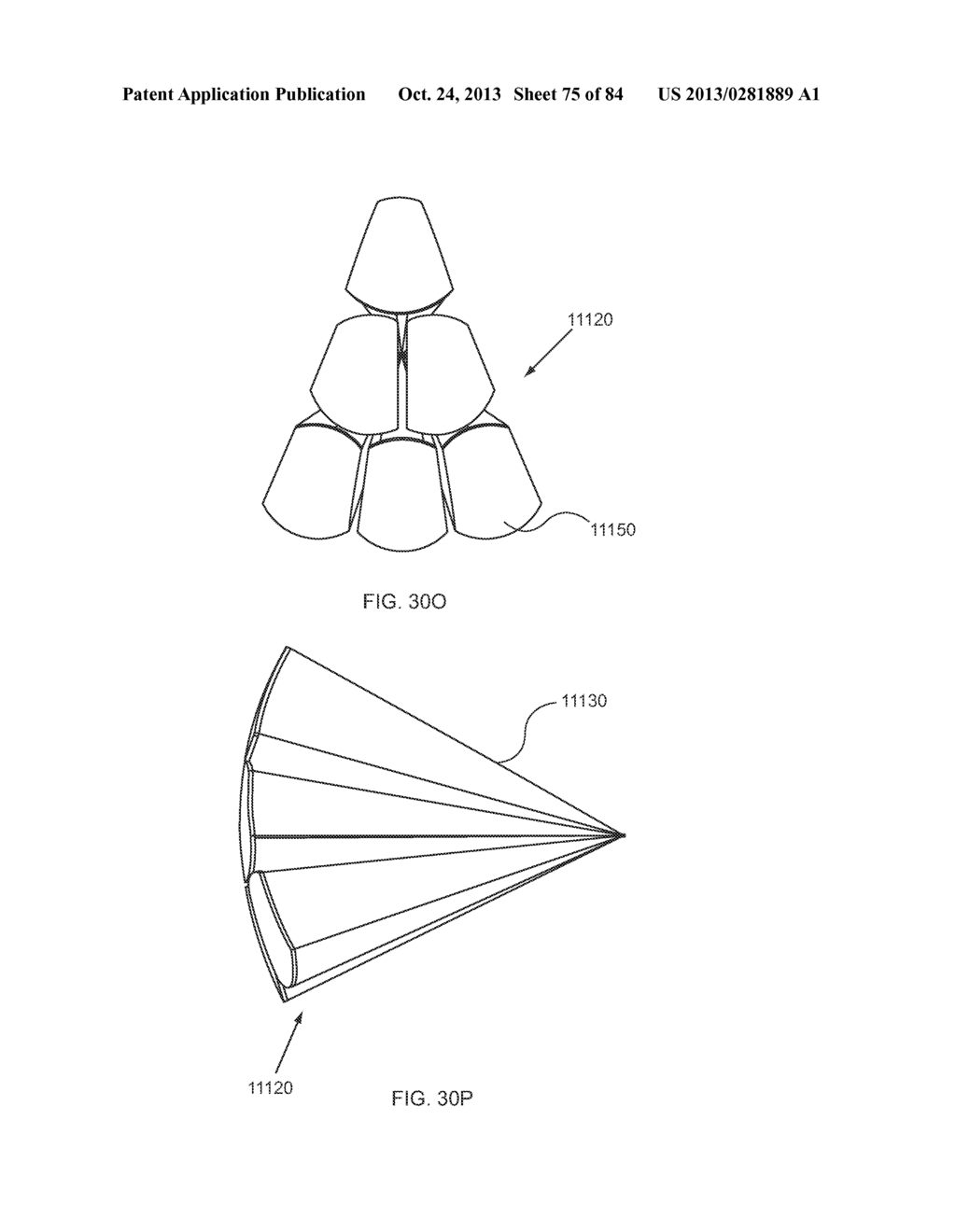 ENERGETIC MODULATION OF NERVES - diagram, schematic, and image 76