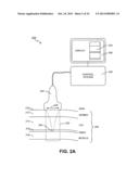 NONINVASIVE AESTHETIC TREATMENT FOR TIGHTENING TISSUE diagram and image