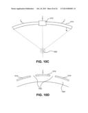 NONINVASIVE AESTHETIC TREATMENT FOR TIGHTENING TISSUE diagram and image