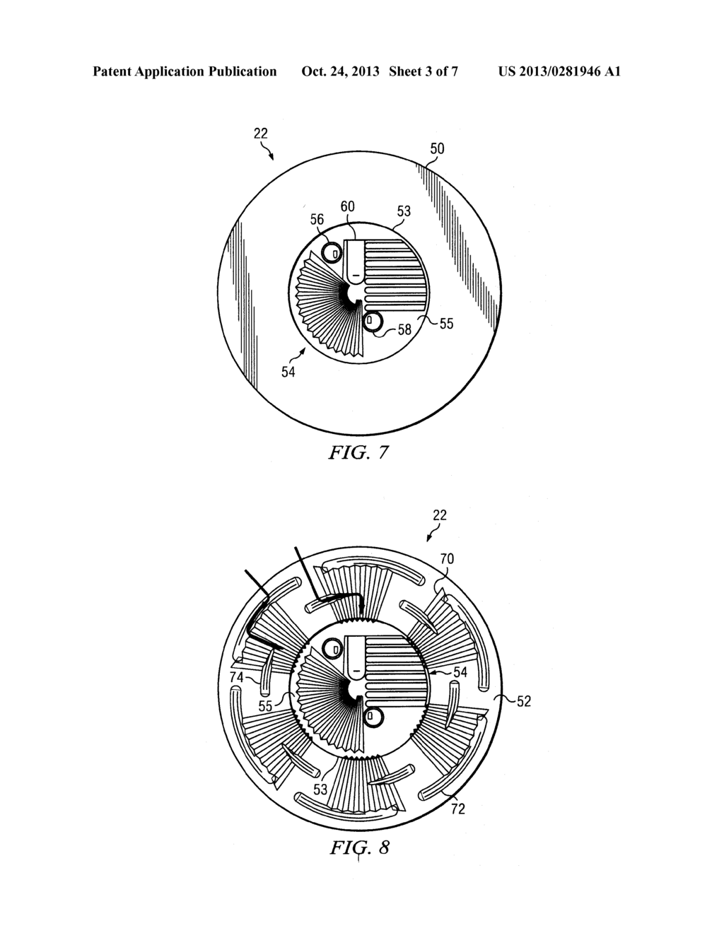 SYSTEMS AND METHODS FOR IMPROVED CONNECTION TO WOUND DRESSINGS IN     CONJUNCTION WITH REDUCED PRESSURE WOUND TREATMENT SYSTEMS - diagram, schematic, and image 04