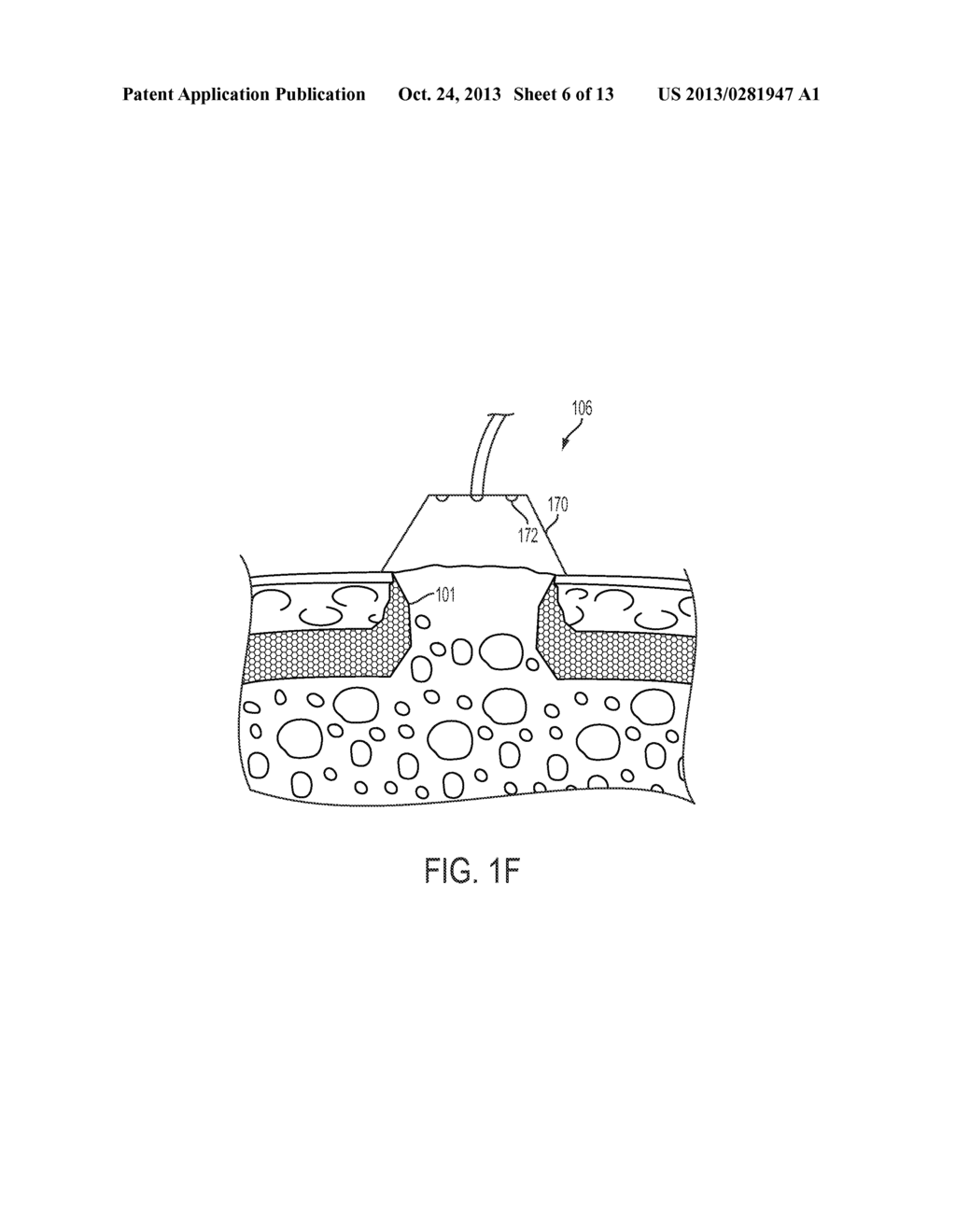 METHOD AND SYSTEM FOR THERAPEUTIC USE OF ULTRA-VIOLET LIGHT - diagram, schematic, and image 07