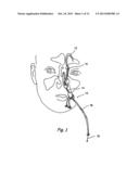 IMPLANTABLE DEVICES AND METHODS FOR DELIVERING DRUGS AND OTHER SUBSTANCES     TO TREAT SINUSITIS AND OTHER DISORDERS diagram and image