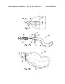 IMPLANTABLE DEVICES AND METHODS FOR DELIVERING DRUGS AND OTHER SUBSTANCES     TO TREAT SINUSITIS AND OTHER DISORDERS diagram and image