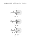 IMPLANTABLE DEVICES AND METHODS FOR DELIVERING DRUGS AND OTHER SUBSTANCES     TO TREAT SINUSITIS AND OTHER DISORDERS diagram and image