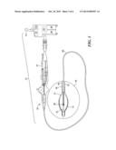 METHOD FOR TREATMENT OF VT USING ABLATION diagram and image