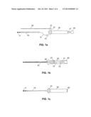 MODULAR CATHETER diagram and image