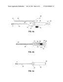 MODULAR CATHETER diagram and image