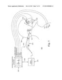 MICRO-RESECTING AND EVOKED POTENTIAL MONITORING SYSTEM AND METHOD diagram and image