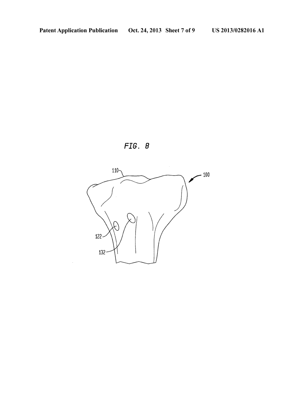 METHODS AND DEVICES FOR LIGAMENT REPAIR - diagram, schematic, and image 08