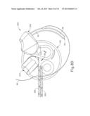 LAPAROSCOPIC SUTURING INSTRUMENT WITH MULTI-DRIVE SEQUENCED TRANSMISSION diagram and image