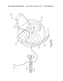 LAPAROSCOPIC SUTURING INSTRUMENT WITH MULTI-DRIVE SEQUENCED TRANSMISSION diagram and image